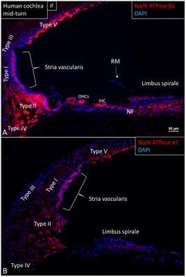 Na/K-ATPase Gene Expression in the Human Cochlea: A Study Using mRNA in situ Hybridization and Super-Resolution Structured Illumination Microscopy